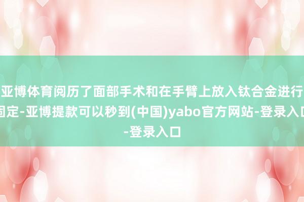 亚博体育阅历了面部手术和在手臂上放入钛合金进行固定-亚博提款可以秒到(中国)yabo官方网站-登录入口
